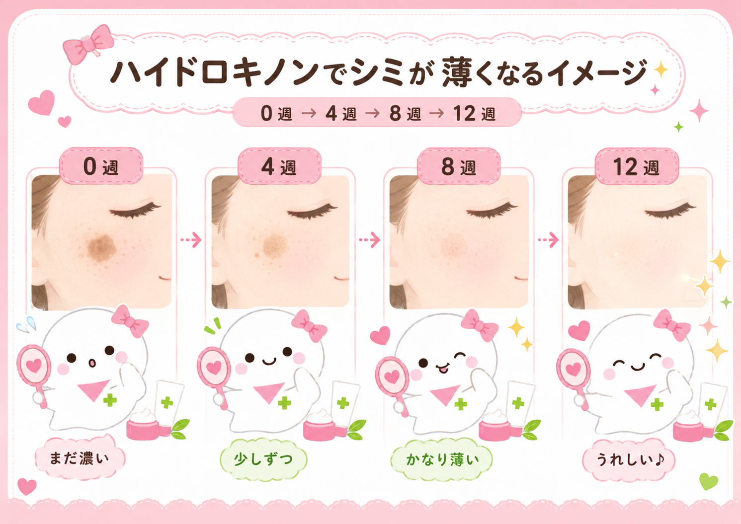 ハイドロキノン使用の経過イメージ(0→4→8→12週)